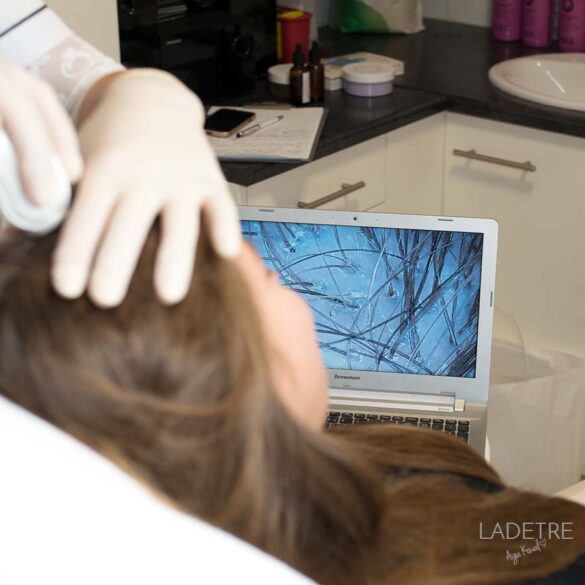 Problemy ze skórą głowy