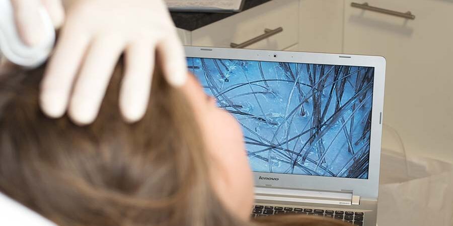 Problemy ze skórą głowy